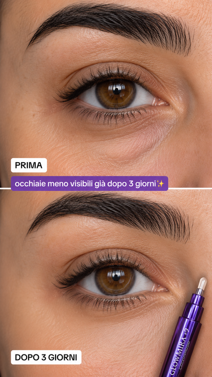 GLOWMIRA  CREMA CONTORNO OCCHI